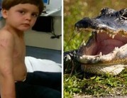 Krokodil támadt egy 6 éves fiúra